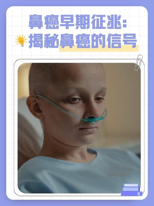 鼻癌的早期症状有哪些