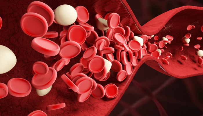 血癌早期症状有哪些?