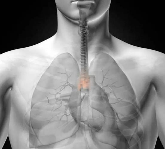 永州胸腺癌如何治疗