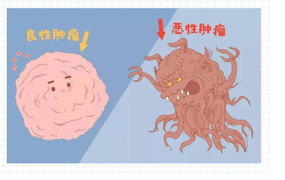 肿瘤是癌症吗?